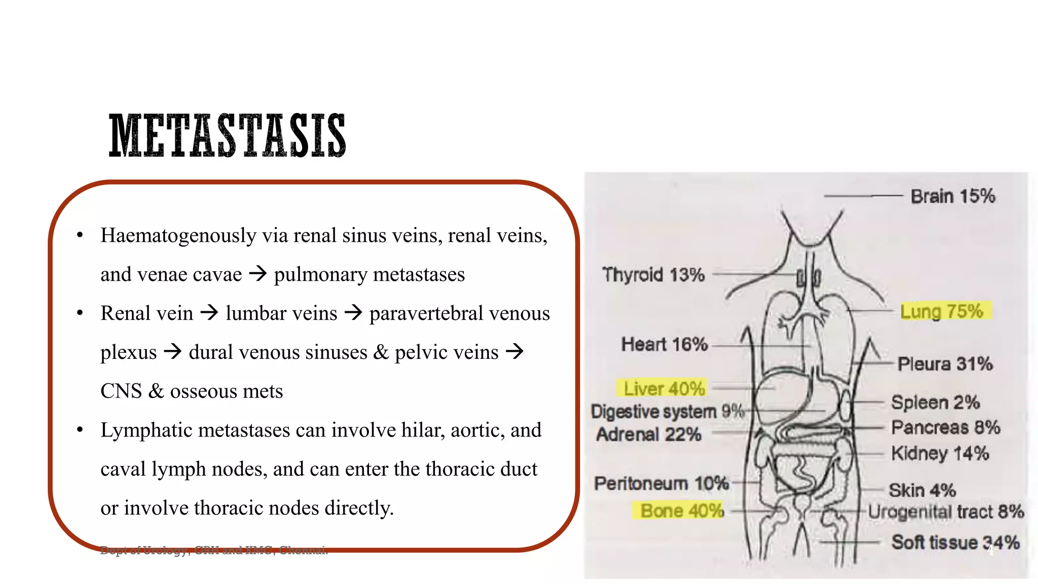 MANAGEMENT OF METASTASIS RENAL CELL CARCINOMA | PDF