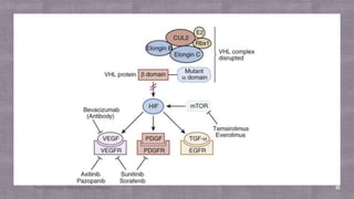 MANAGEMENT OF METASTASIS RENAL CELL CARCINOMA | PDF
