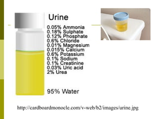 http://cardboardmonocle.com/v-web/b2/images/urine.jpg 
