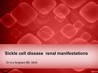 Sickle cell disease renal manifestations
Dr m.s forghani MD, MUK
 