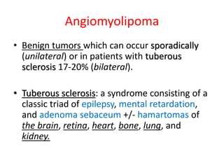 Angiomyolipoma
• Benign tumors which can occur sporadically
(unilateral) or in patients with tuberous
sclerosis 17-20% (bilateral).
• Tuberous sclerosis: a syndrome consisting of a
classic triad of epilepsy, mental retardation,
and adenoma sebaceum +/- hamartomas of
the brain, retina, heart, bone, lung, and
kidney.
 