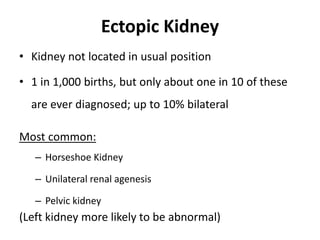 Ectopic Kidney
• Kidney not located in usual position
• 1 in 1,000 births, but only about one in 10 of these
are ever diagnosed; up to 10% bilateral
Most common:
– Horseshoe Kidney
– Unilateral renal agenesis
– Pelvic kidney
(Left kidney more likely to be abnormal)
 