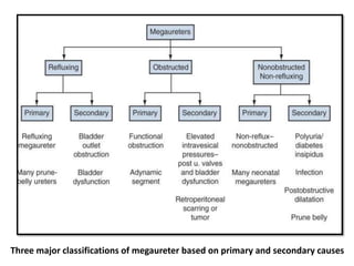 Three major classifications of megaureter based on primary and secondary causes
 