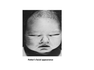 Potter's facial appearance
 