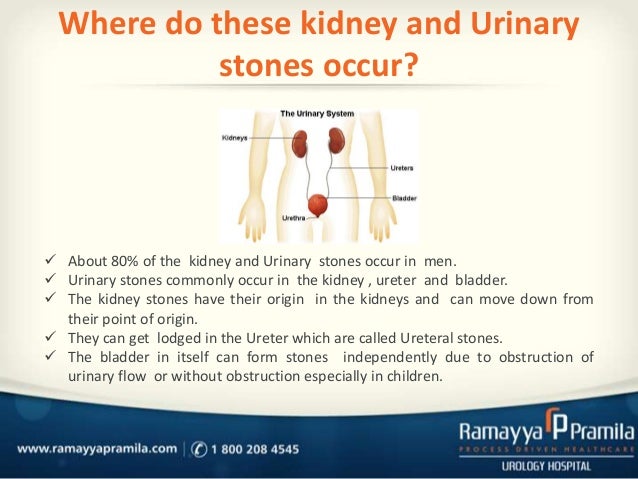 Kidney and urinary stone