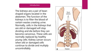 The kidneys are a pair of bean
shaped organs located in the
abdomen. The function of the
kidneys is to filter the blood of
certain wastes creating urine.
Normally, cells in the kidneys that
are old or damaged will stop
dividing and die before they can
become cancerous. These cells are
normally replaced by healthy
young cells. Kidney cancer occurs
when old or damaged cells
continue to divide and multiply
uncontrollably
introduction
 