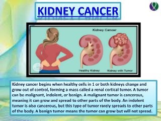 Types of kidney cancer and its cells by Thecureforcancer