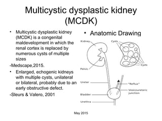 Mcdk Ras Kidney disease | PPT
