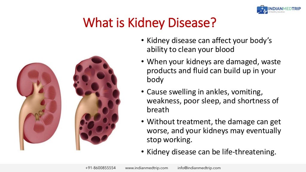 Kidney disease early detection and treatment