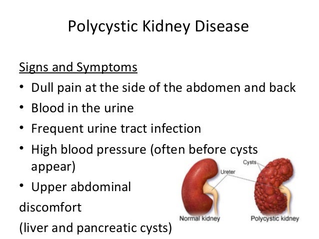 polycystic kidney disease current interests biology essay The first clinical descriptions of autosomal dominant polycystic kidney disease cell biology, and genetics the is scientifically sound in its current form. polycystic kidney disease current interests biology essay The first clinical descriptions of autosomal dominant polycystic kidney disease cell biology, and genetics the is scientifically sound in its current form.