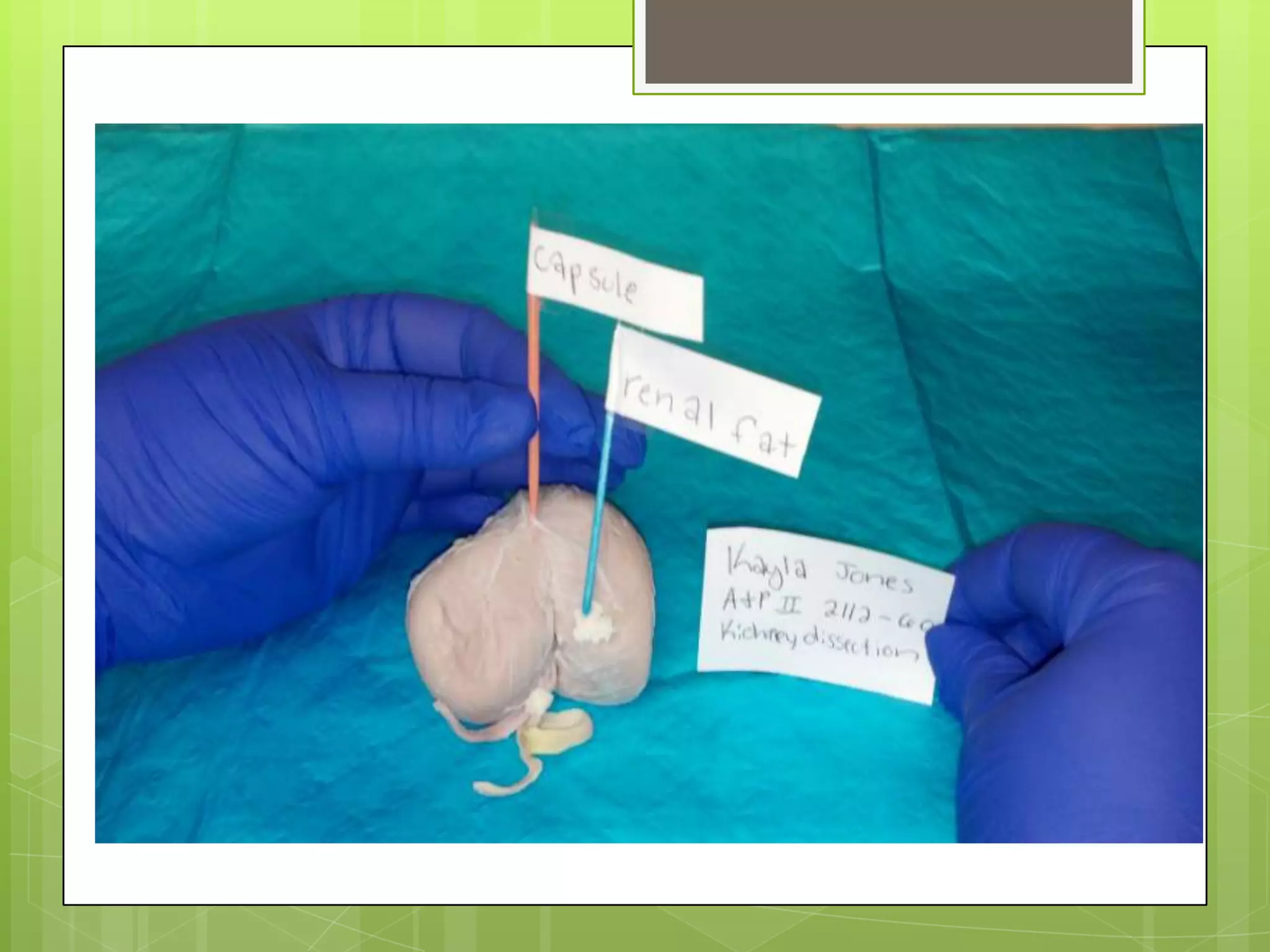 Kidney Dissection Pptx
