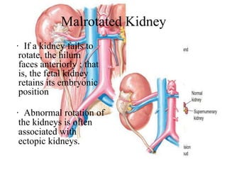 Kidney embryology | PPTX