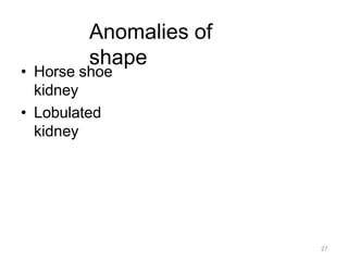 27
Anomalies of
shape
• Horse shoe
kidney
• Lobulated
kidney
 