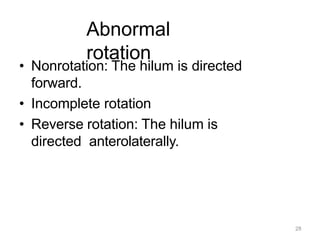 28
Abnormal
rotation
• Nonrotation: The hilum is directed
forward.
• Incomplete rotation
• Reverse rotation: The hilum is
directed anterolaterally.
 