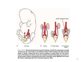 kidney embryoloGY.pptx