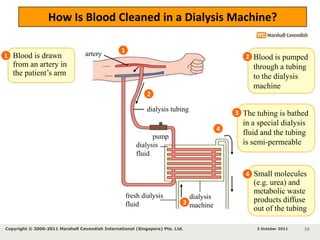 arteryHow Is Blood Cleaned in a Dialysis Machine?1Blood is drawn from an artery in the patient’s arm13 October 2011Copyright © 2006-2011 Marshall Cavendish International (Singapore) Pte. Ltd. 7