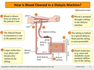 arterydialysis tubingdialysisfluidfresh dialysisfluiddialysismachineHow Is Blood Cleaned in a Dialysis Machine?1Blood is drawn from an artery in the patient’s armBlood is pumped through a tubing to the dialysis machine122The tubing is bathed in a special dialysis fluid and the tubing is semi-permeable3pump33 October 2011Copyright © 2006-2011 Marshall Cavendish International (Singapore) Pte. Ltd. 9