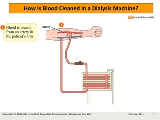 Kidney failurePossible cure / treatment?Kidney transplantDialysisHaemodialysis using Dialysis machinePeritoneal dialysis using membranes/bag