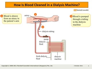 Dialysis5