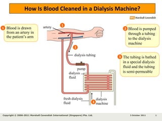      Differences between haemodialysis          and peritoneal dialysis