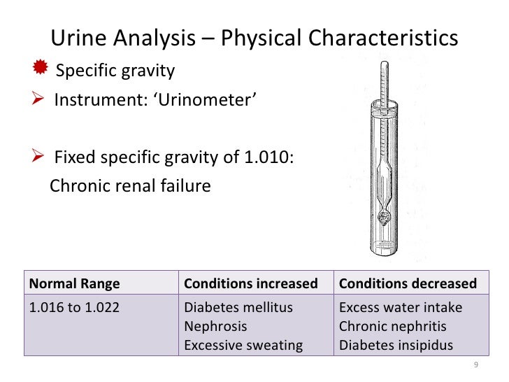 high specific gravity of urine high specific gravity of urine