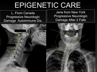 Jane from New York
Progressive Neurologic
Damage After 2 Falls
L. From Canada
Progressive Neurologic
Damage Autoimmune Dis.
EPIGENETIC CARE
 