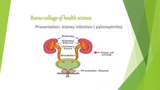 Burao collage of health science
Presentation: kidney infection ( pylonephritis)
 