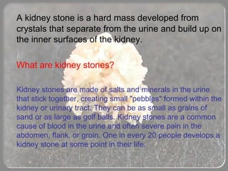 Kidney Stone | PPT