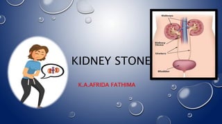 KIDNEY STONE
K.A.AFRIDA FATHIMA
 