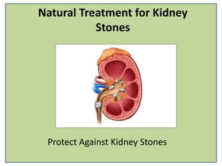Natural Treatment for Kidney
Stones
Protect Against Kidney Stones
 