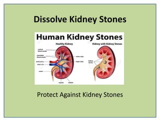 Dissolve Kidney Stones
Protect Against Kidney Stones
 