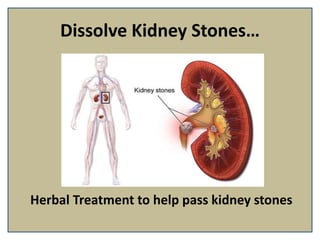 Dissolve Kidney Stones…
Herbal Treatment to help pass kidney stones
 