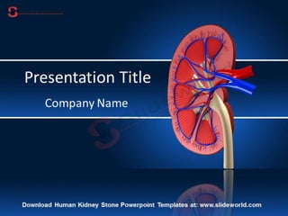 Human Kidney Stone Powerpoint Templates - SlideWorld