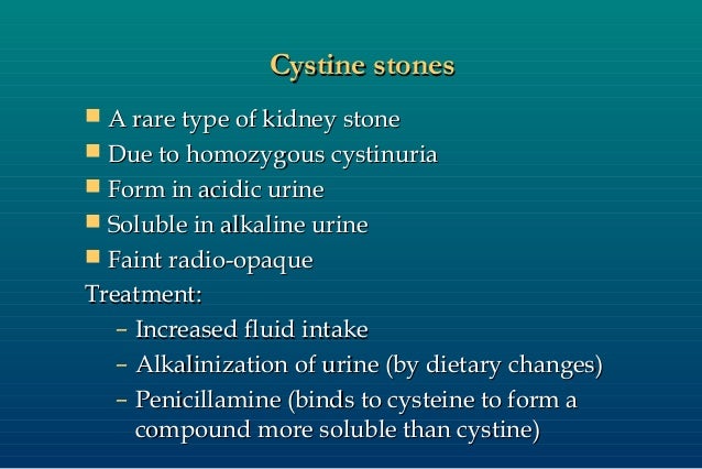 DR. rahul dandekar - Kidney stones