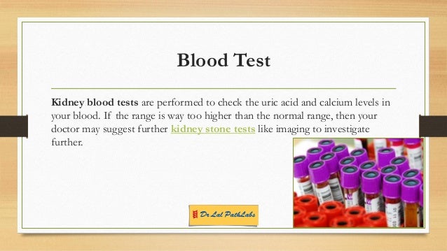 Kidney Stones Tests And Diagnosis