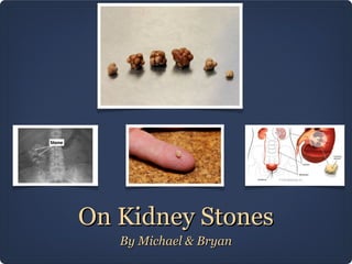 On Kidney Stones
By Michael & Bryan

 