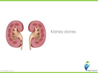 Kidney stones




© 2012 Right Doctor
 