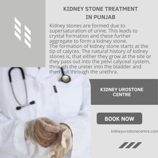 KIDNEY STONE TREATMENT
IN PUNJAB
Kidney stones are formed due to
supersaturation of urine. This leads to
crystal formation and these further
aggregate to form a kidney stone.
The formation of kidney stone starts at the
tip of calyces. The natural history of kidney
stones is, that either they grow at the site or
they pass out into the pelvi calyceal system,
through the ureter into the bladder and
then out through the urethra.
KIDNEY UROSTONE
CENTRE
BOOK NOW
kidneyurostonecentre.com
 