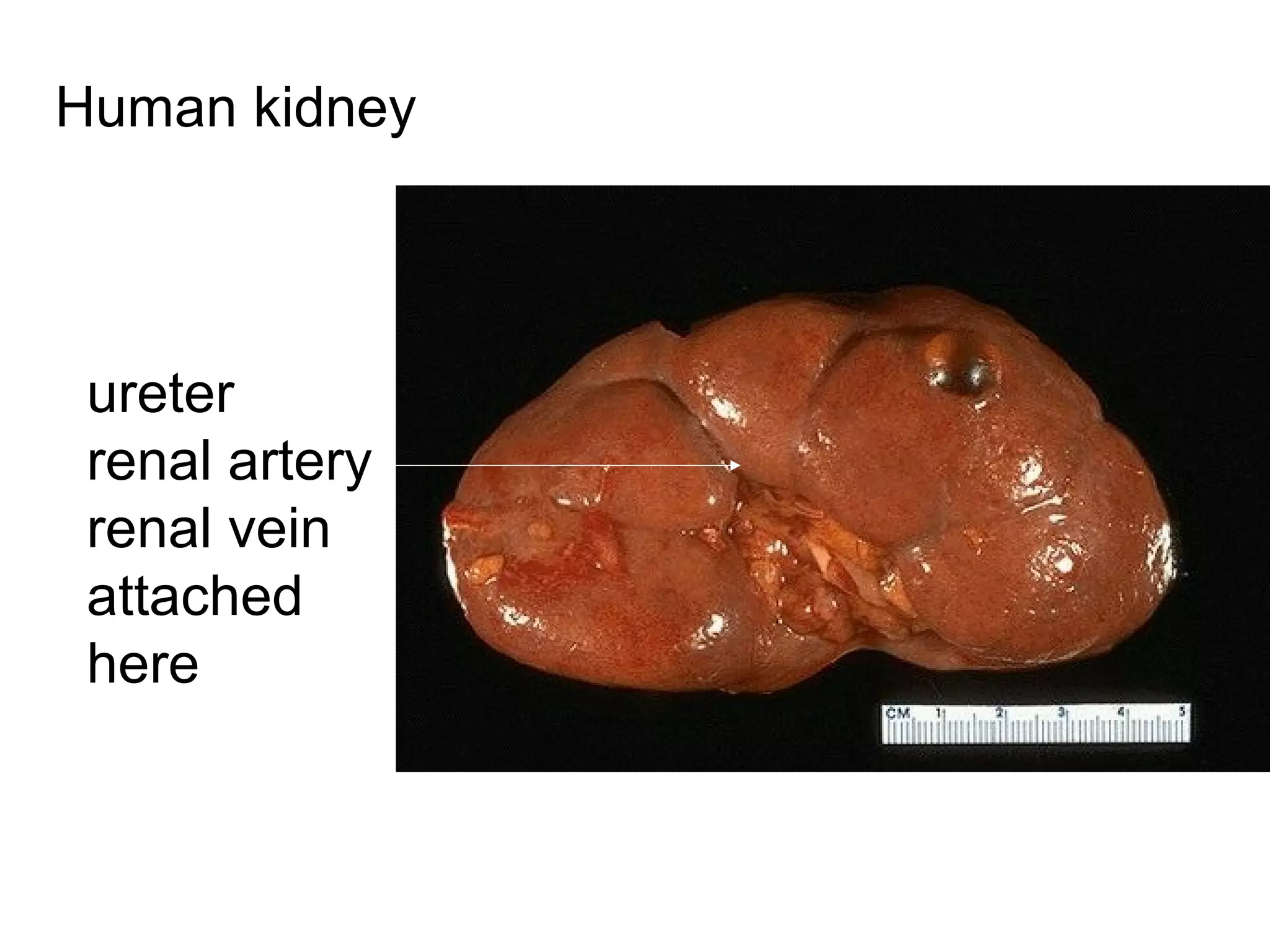 Human kidney
ureter
renal artery
renal vein
attached
here
 