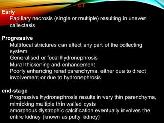 IMAGING FEATURES IN RENAL TUBERCULOSIS | PPTX