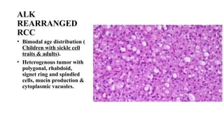 RENAL pathology For post graduates in pathology by Dr. Nancy Gupta pptx ...
