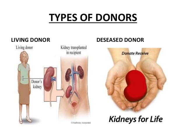 Tipos de transplante renal