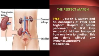 THE PERFECT MATCH
1954 - Joseph E. Murray and
his colleagues at Peter Bent
Brigham Hospital in Boston
performed the first truly
successful kidney transplant
from one twin to another. This
was done without any
immunosuppressive
medication.
 