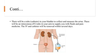 KIDNEY TRANSPLATATION.pptx