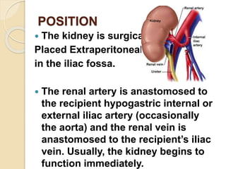 kidneytrnaplantaion-181204053135.pdf