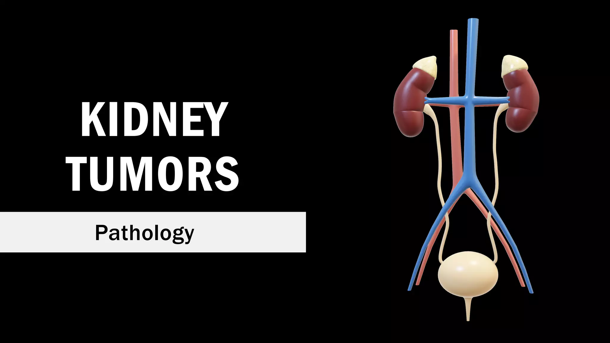 KIDNEY
TUMORS
Pathology
 
