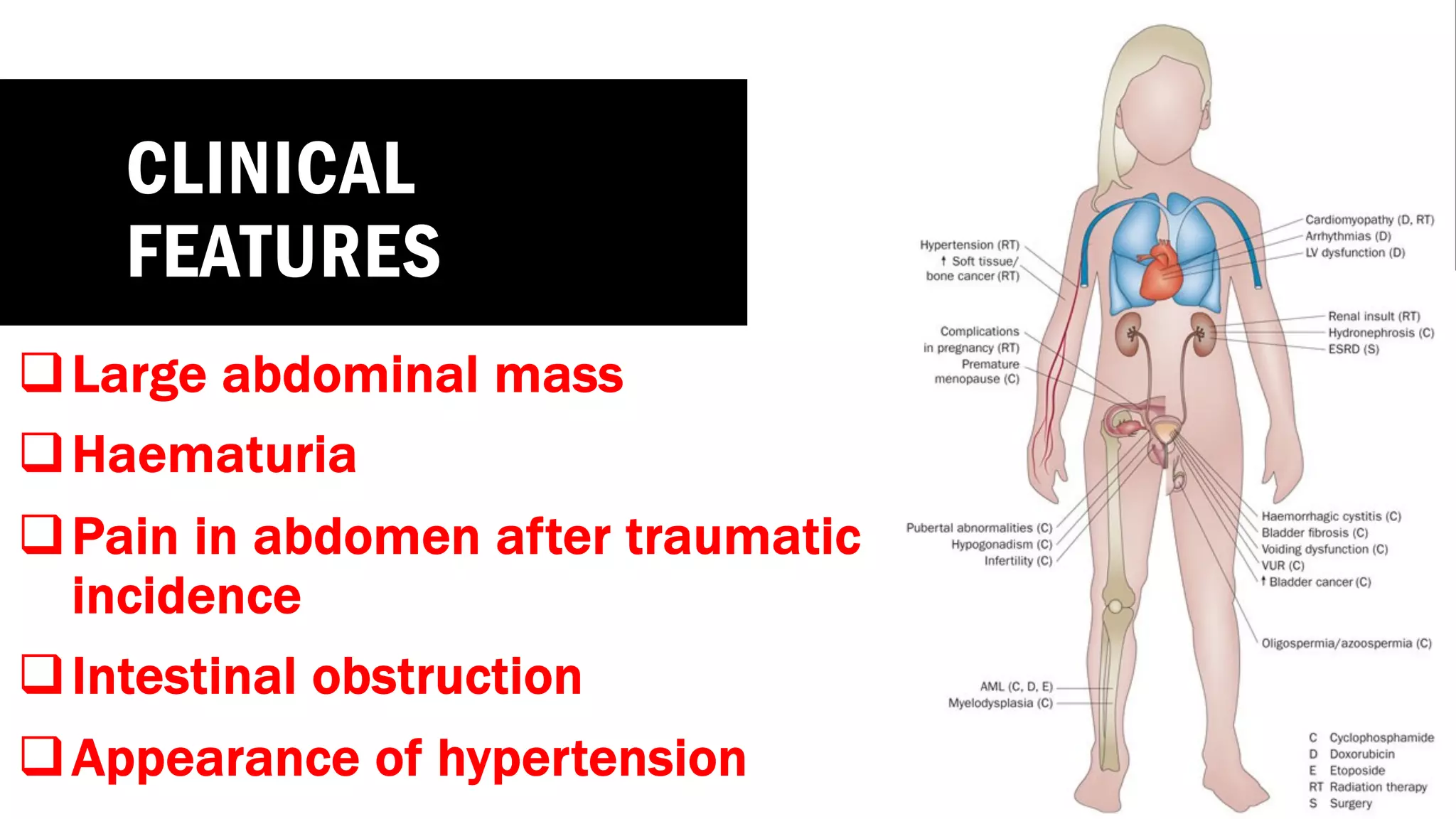 CLINICAL
FEATURES
qLarge abdominal mass
qHaematuria
qPain in abdomen after traumatic
incidence
qIntestinal obstruction
qAppearance of hypertension
 