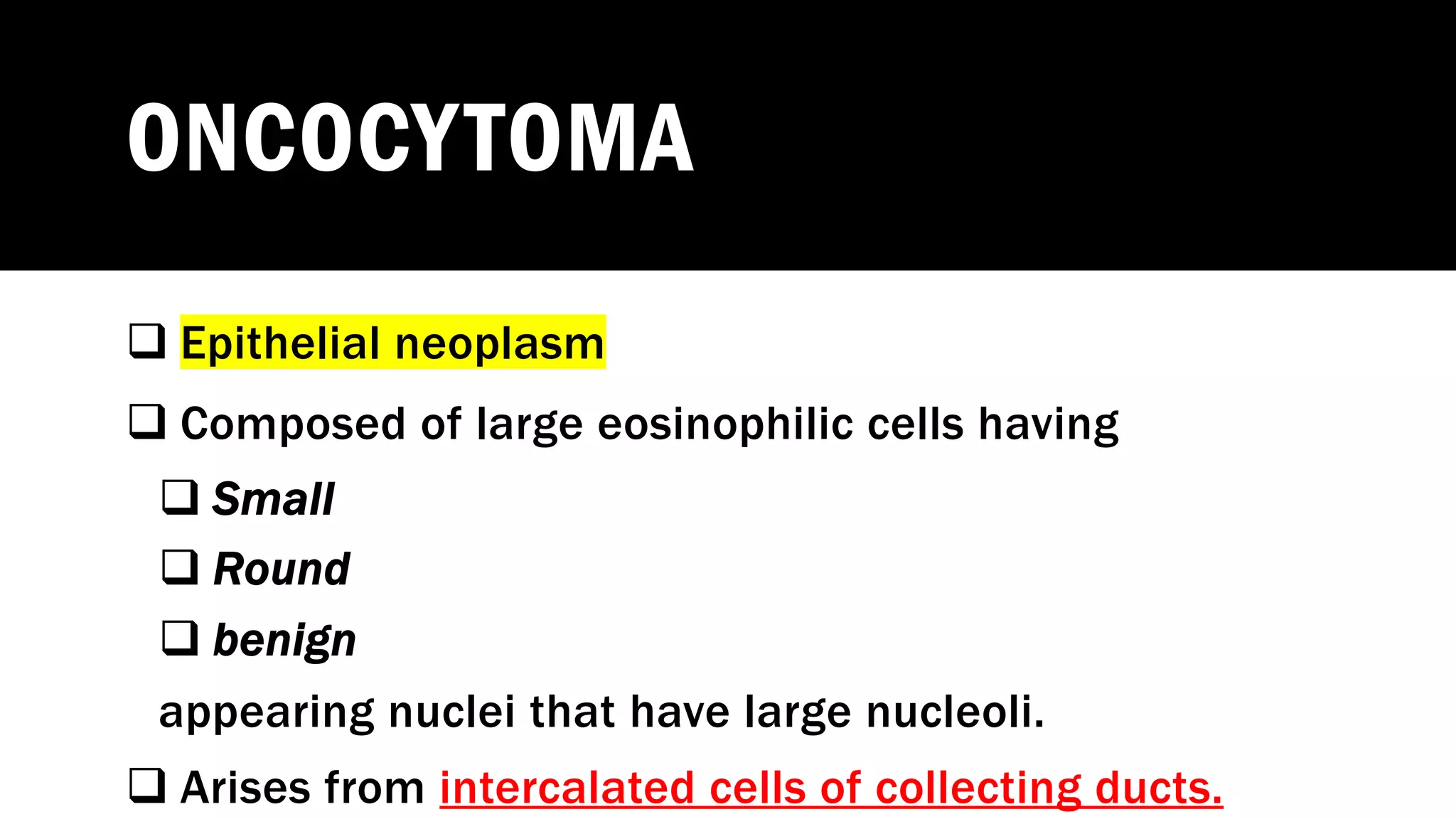 ONCOCYTOMA
q Epithelial neoplasm
q Composed of large eosinophilic cells having
q Small
q Round
q benign
appearing nuclei that have large nucleoli.
q Arises from intercalated cells of collecting ducts.
 