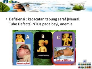 • Defisiensi : kecacatan tabung saraf (Neural
Tube Defects) NTDs pada bayi, anemia
 