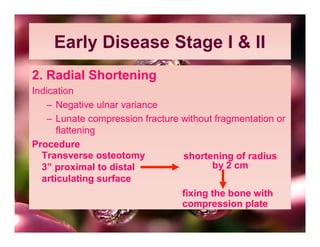 Early Disease Stage I & II
2. Radial Shortening
Indication
   – Negative ulnar variance
   – Lunate compression fracture without fragmentation or
      flattening
Procedure
  Transverse osteotomy           shortening of radius
  3” proximal to distal                 by 2 cm
  articulating surface
                                 fixing the bone with
                                 compression plate
 